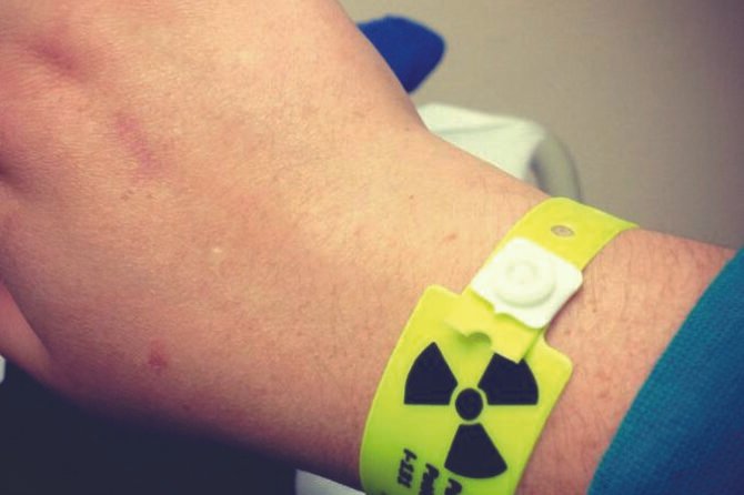 What to Know About Radioactive Iodine Therapy