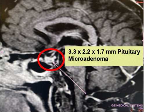 CHASING SHADOWS: The Search For Clarity